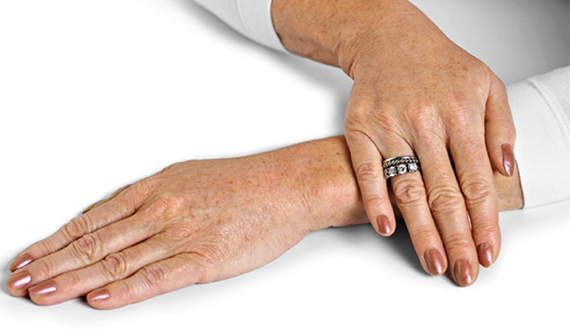 Омоложение кистей рук